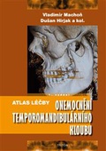 obálka: Atlas léčby onemocnění temporomandibulárního kloubu