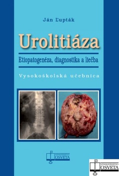 obálka: Urolitiáza. Etiopatogenéza, diagnostika a liečba