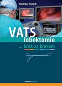 obálka: VATS lobektomie krok za krokem