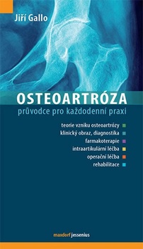 obálka: Osteoartróza