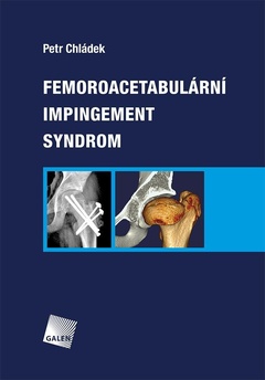 obálka: Femoroacetabulární impingement syndrom