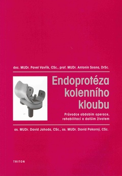 obálka: Endoprotéza kolenního kloubu