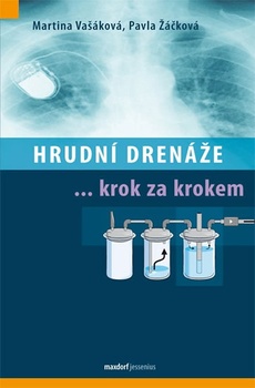 obálka: Hrudní drenáže krok za krokem